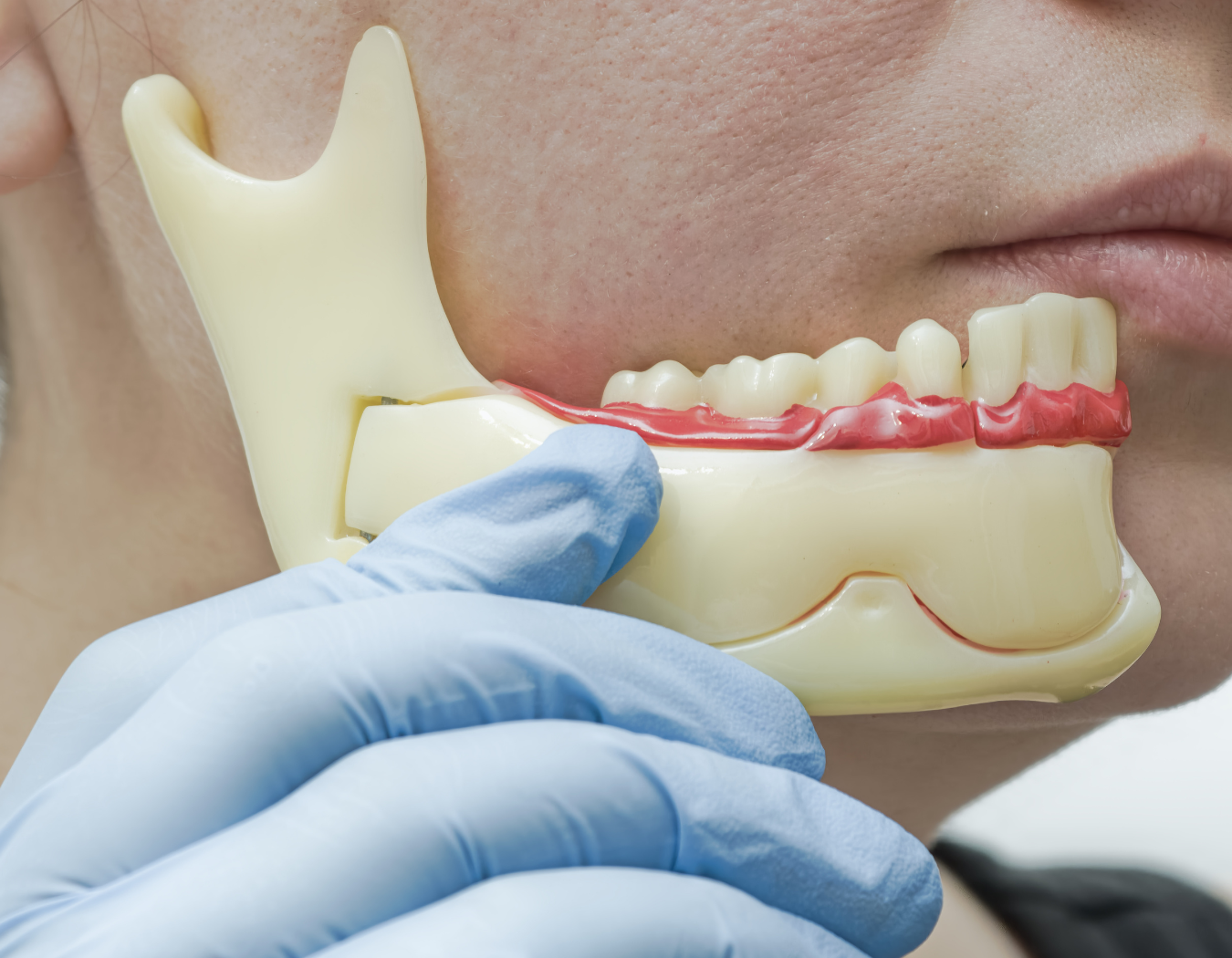 Orthognathic (Jaw) Surgery Coordination